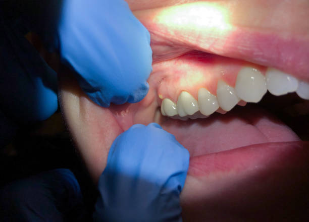 Best Emergency Treatment for Toothache in Baidland, PA
