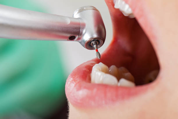 Best Pediatric Emergency Dentist in Baidland, PA